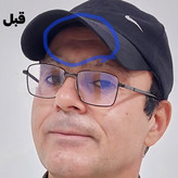 کرم لیفتینگ پوست ۱۲۰ میلی لاکچری کوین | دارای مکمل شاداب کننده منحصر به فرد کاهش شگفت انگیز چین و چروک