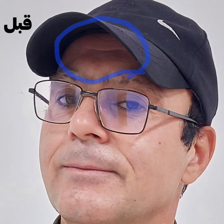 کرم لیفتینگ پوست ۱۲۰ میلی لاکچری کوین | دارای مکمل شاداب کننده منحصر به فرد کاهش شگفت انگیز چین و چروک
