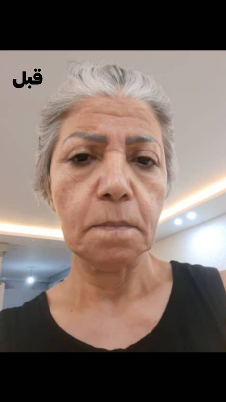 سرم لیفتینگ صورت گاتیو ۳۰ میل رطوبت رسان کاهش چین و چروکهای ریز و سفت کننده