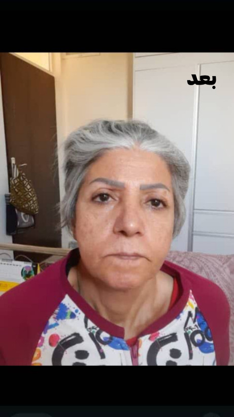 کرم لیفتینگ پوست ۱۲۰ میلی لاکچری کوین | دارای مکمل شاداب کننده منحصر به فرد کاهش شگفت انگیز چین و چروک