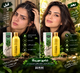 شامپو مورینگا و تونیک هرفرند ترکیب عالی برای رفع چربی سر و جلوگیری از ریزش مو